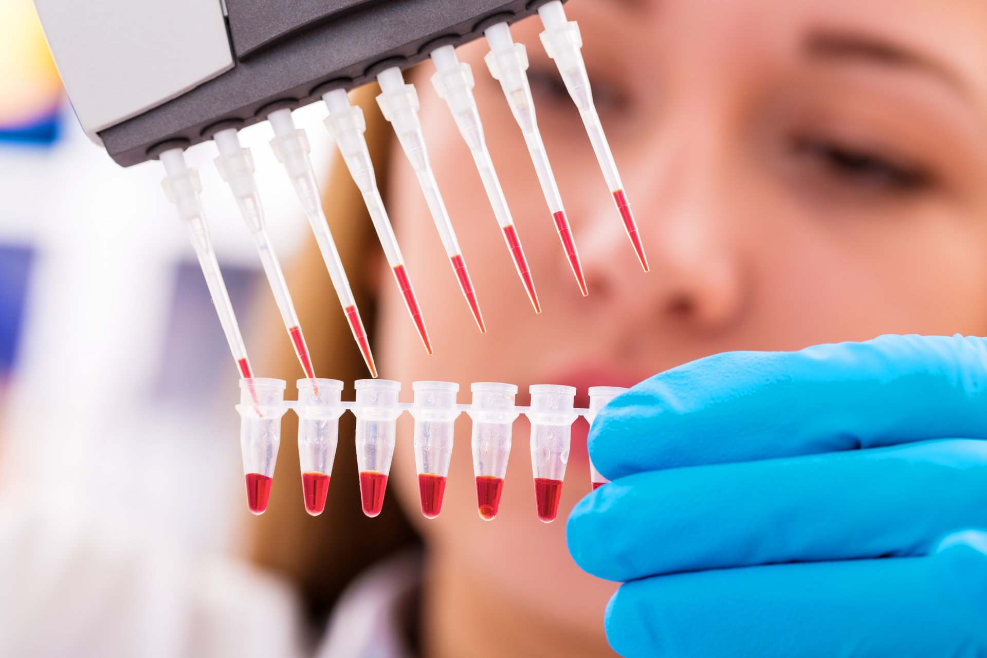 Insumos para laboratorio clinico